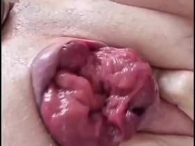 脱肛玩弄 chinese balled 1 blithe porn